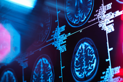 technology neurology clinic