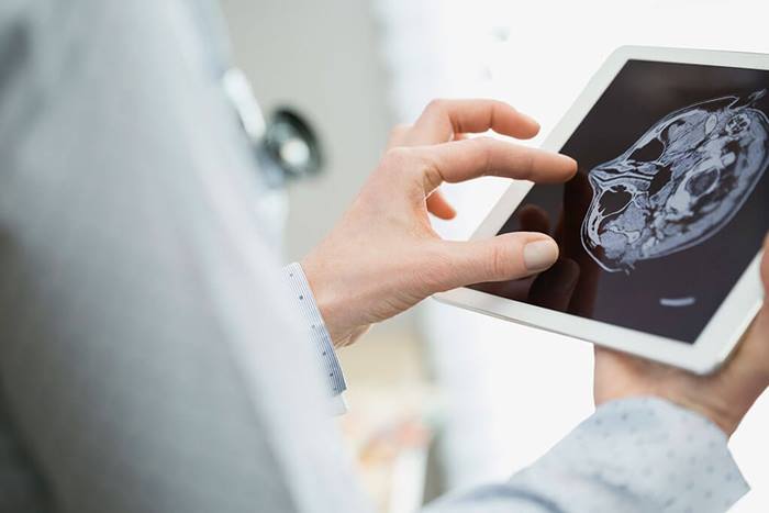 Female doctor examining brain scan on tablet